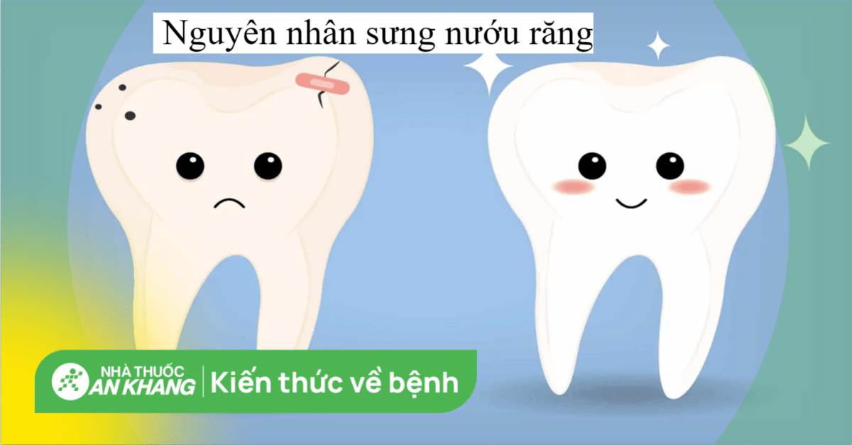 Phương pháp chữa trị viêm nướu răng hiệu quả nhất là gì?