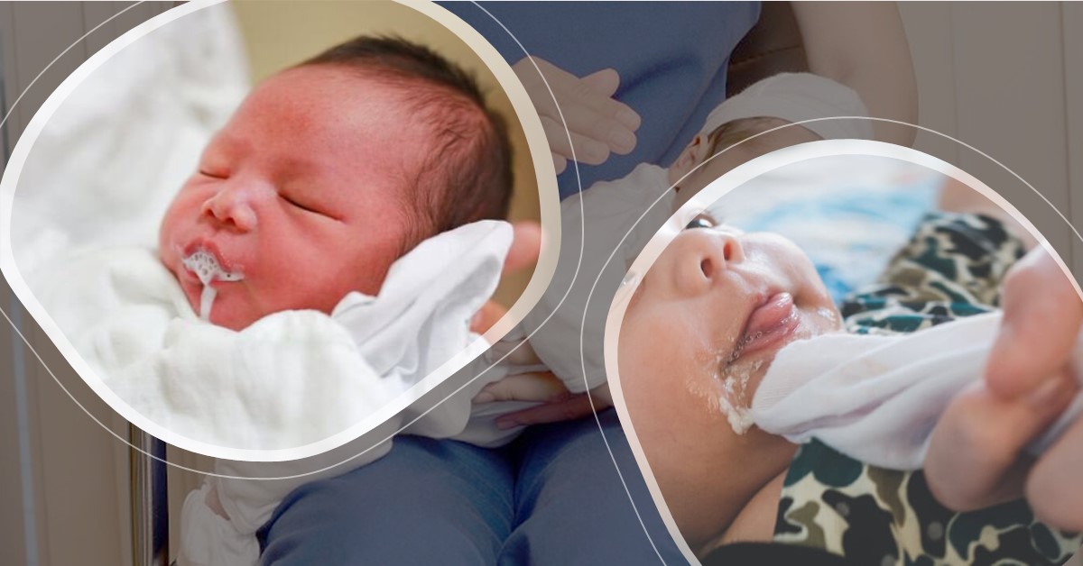Cách xử lý nôn trớ ở trẻ sơ sinh an toàn nhất mà ba mẹ cần biết