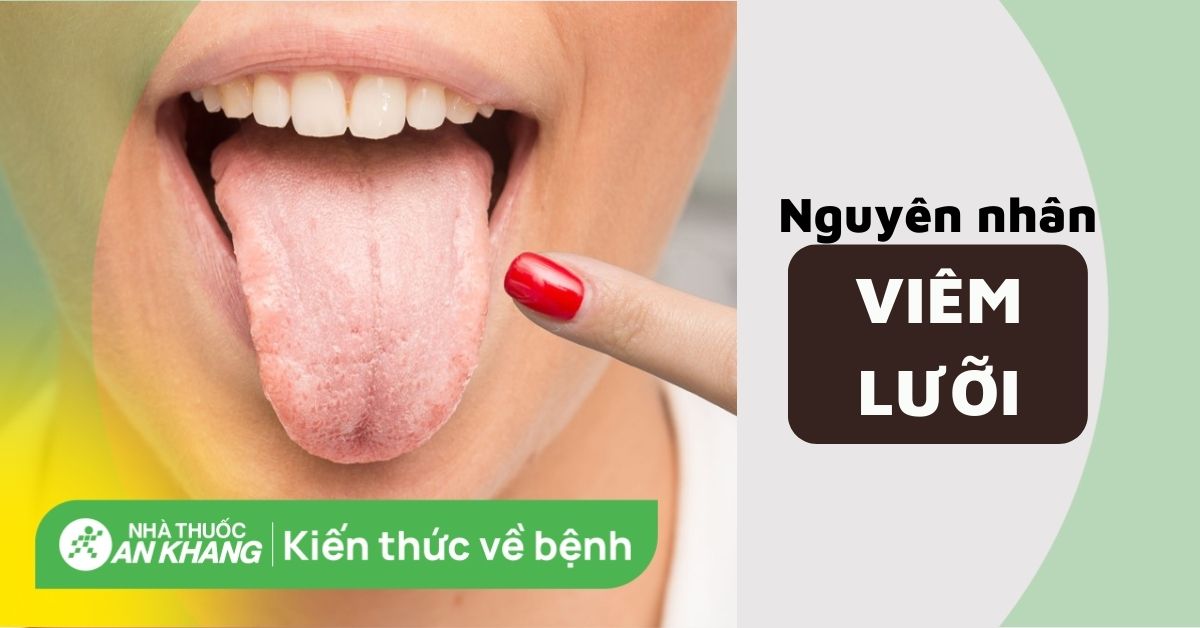 Liệu viêm lưỡi có liên quan đến các bệnh lý khác không?