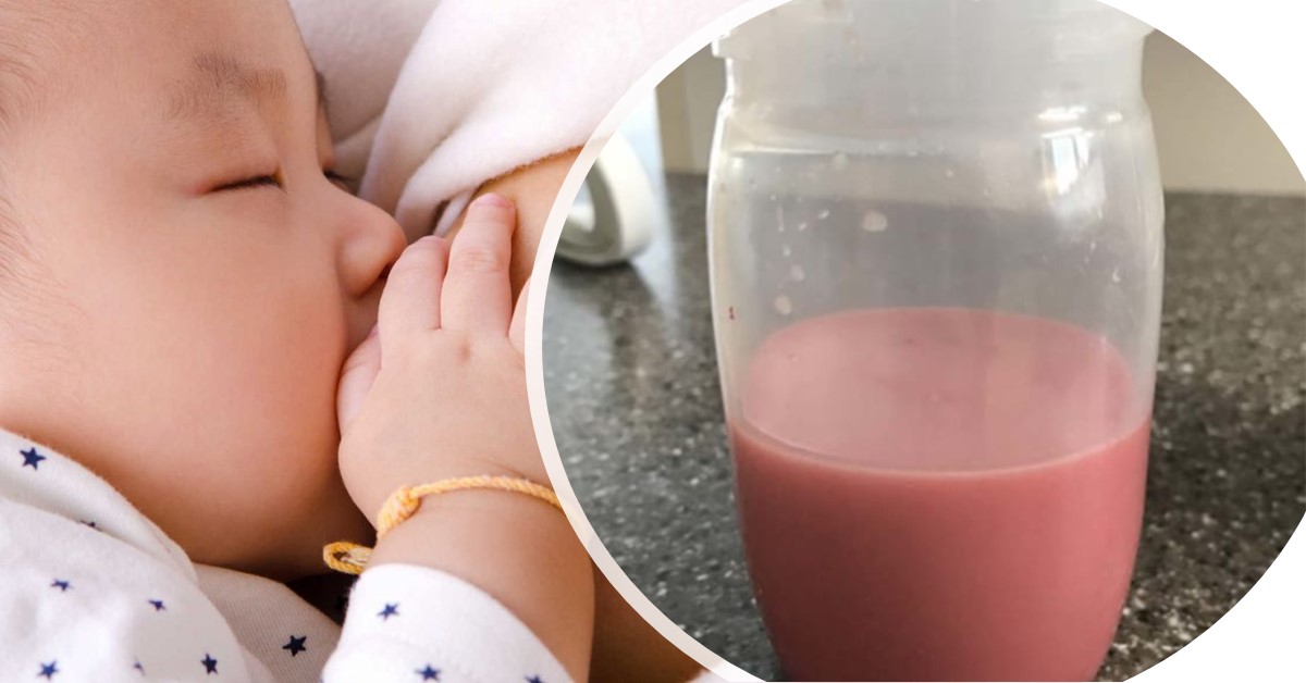 Cách phòng ngừa có máu trong sữa mẹ hiệu quả nhất