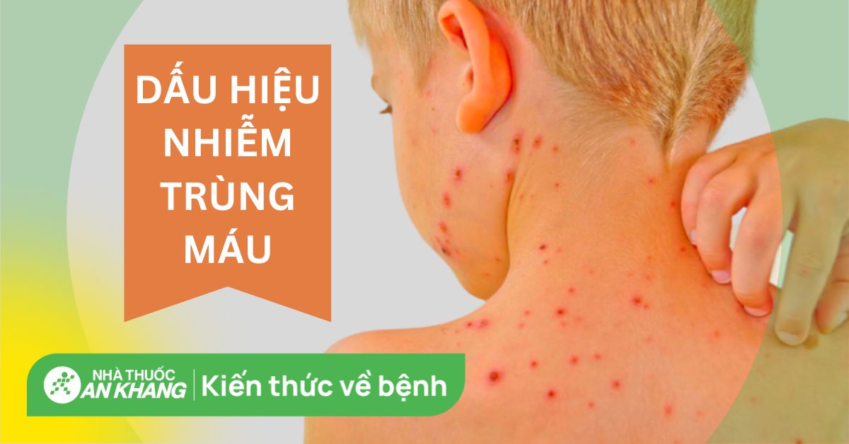 Triệu Chứng Của Bệnh Nhiễm Trùng Máu: Hiểu Rõ Để Điều Trị Kịp Thời