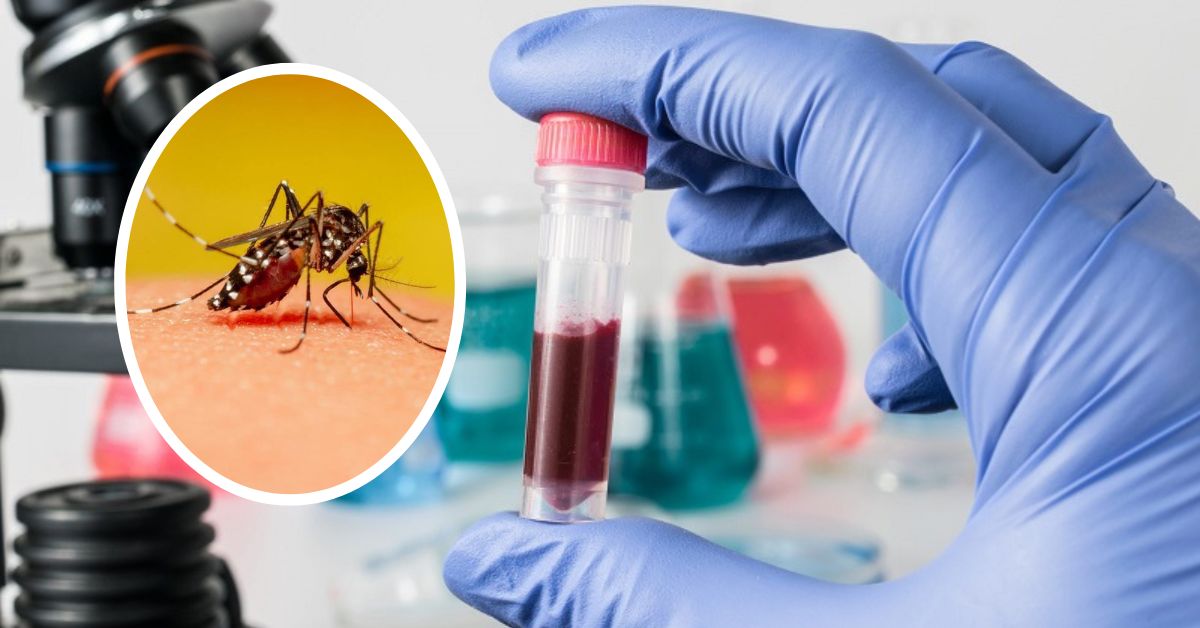 Gợi ý những địa điểm xét nghiệm sốt xuất huyết uy tín nhất