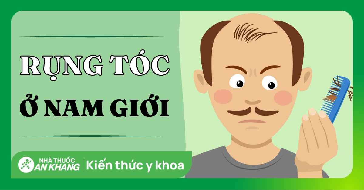 Cải thiện tình trạng hói đầu ở nam giới - Nhà thuốc FPT Long Châu