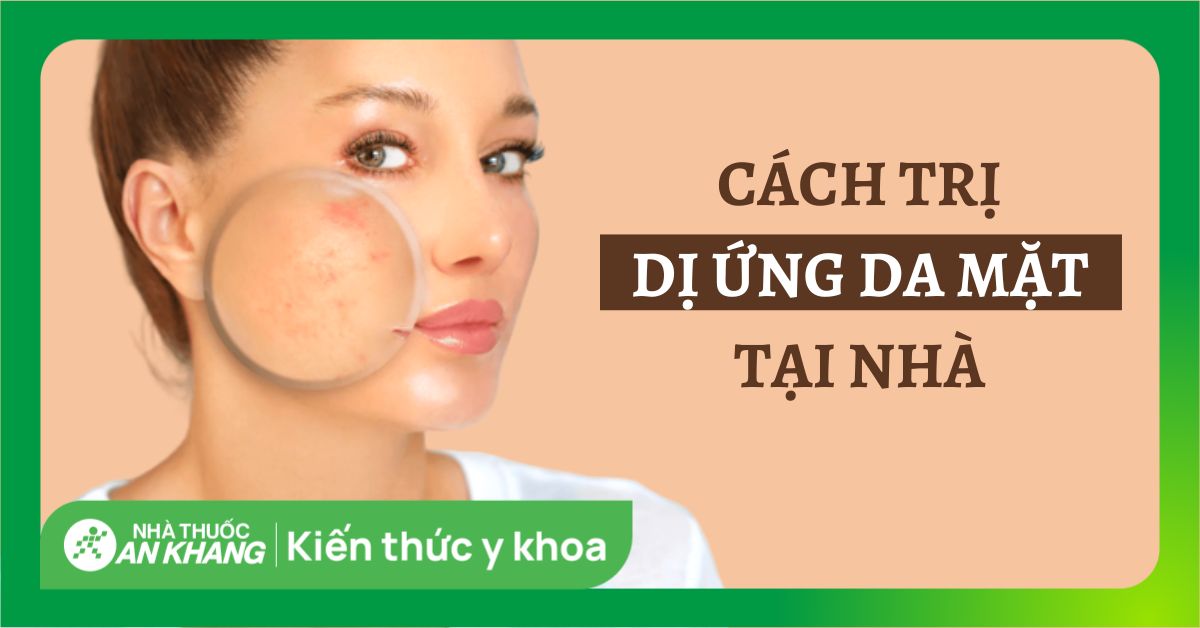 Cách Trị Dị Ứng Da Mặt Tại Nhà: Hiệu Quả và An Toàn