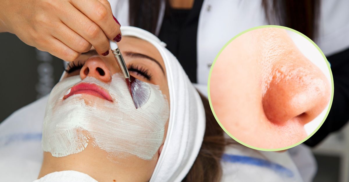 Gợi ý cho mẹ cách chăm sóc da mặt dầu giúp da sáng mịn