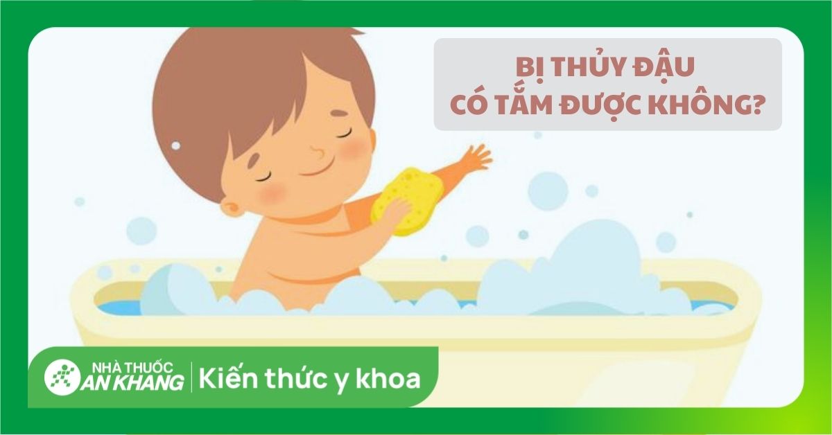 Bị thủy đậu có tắm được không? 12 mẹo và lưu ý tắm cho người thủy đậu