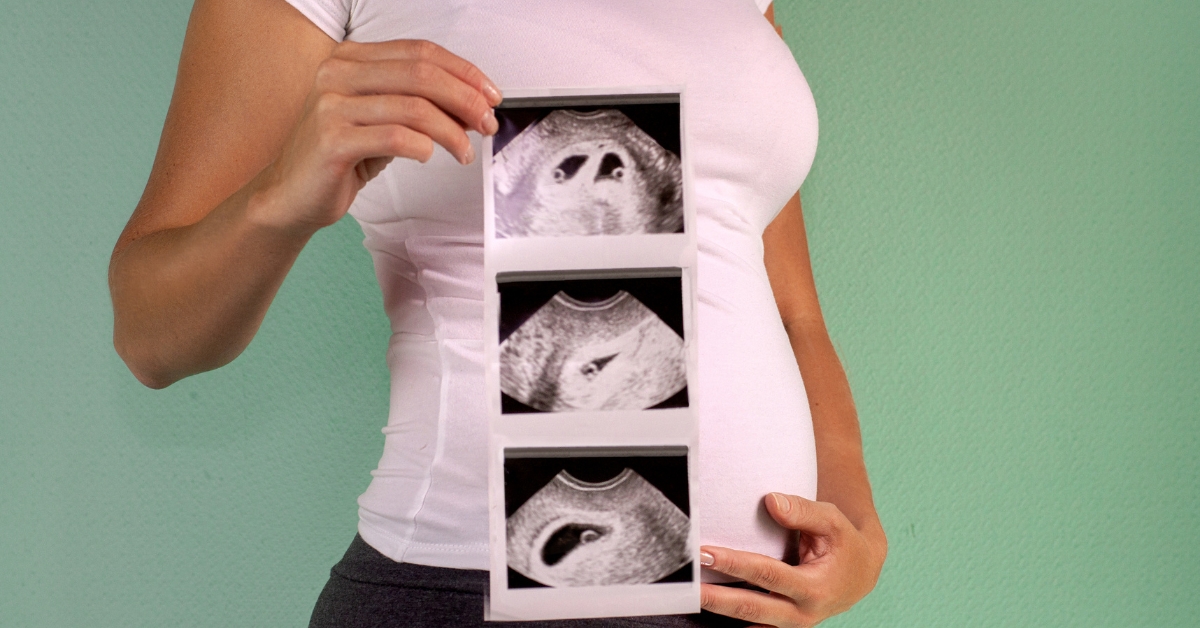 Thai nhi 12 tuần tuổi phát triển như thế nào? Những xét nghiệm cần thực hiện ở tuần 12 của thai kỳ