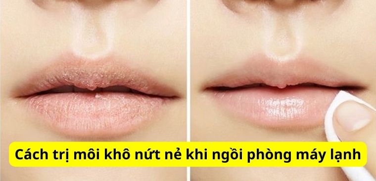 Cách trị môi khô nứt nẻ khi ngồi phòng máy lạnh