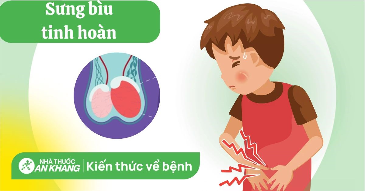 Sưng bìu tinh hoàn có nguy hiểm không? Nguyên nhân và cách điều trị