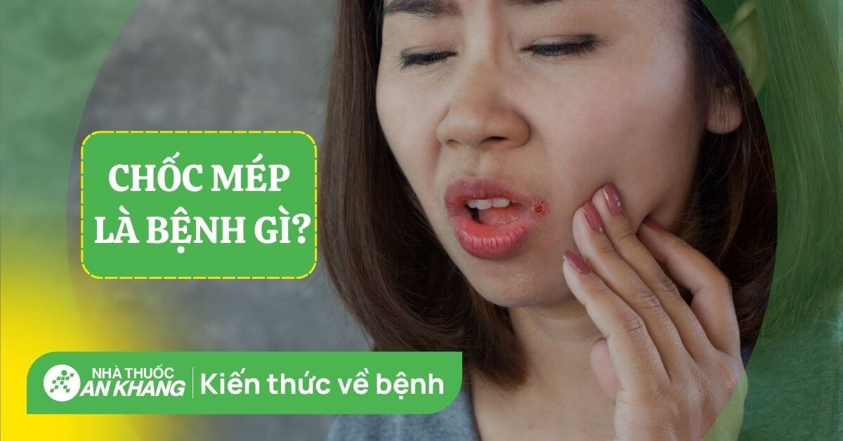 Chốc mép (lở mép): Nguyên nhân và cách khắc phục hiệu quả