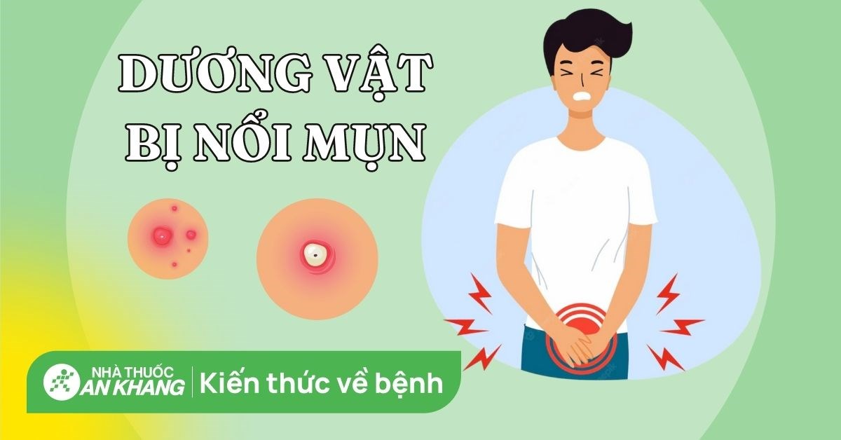 Dương vật nổi mụn là bệnh gì? Nguyên nhân và cách điều trị