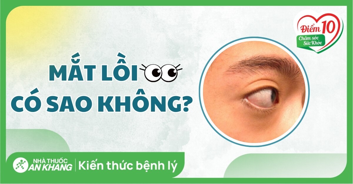 Mắt lồi có sao không? Nguyên nhân và cách khắc phục hiệu quả