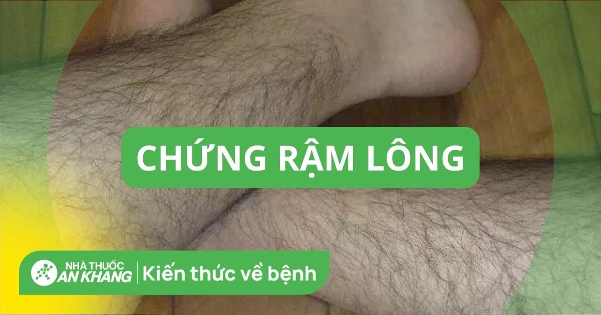 Chứng rậm lông (lông phát triển quá mức) là gì? Điều trị thế nào?