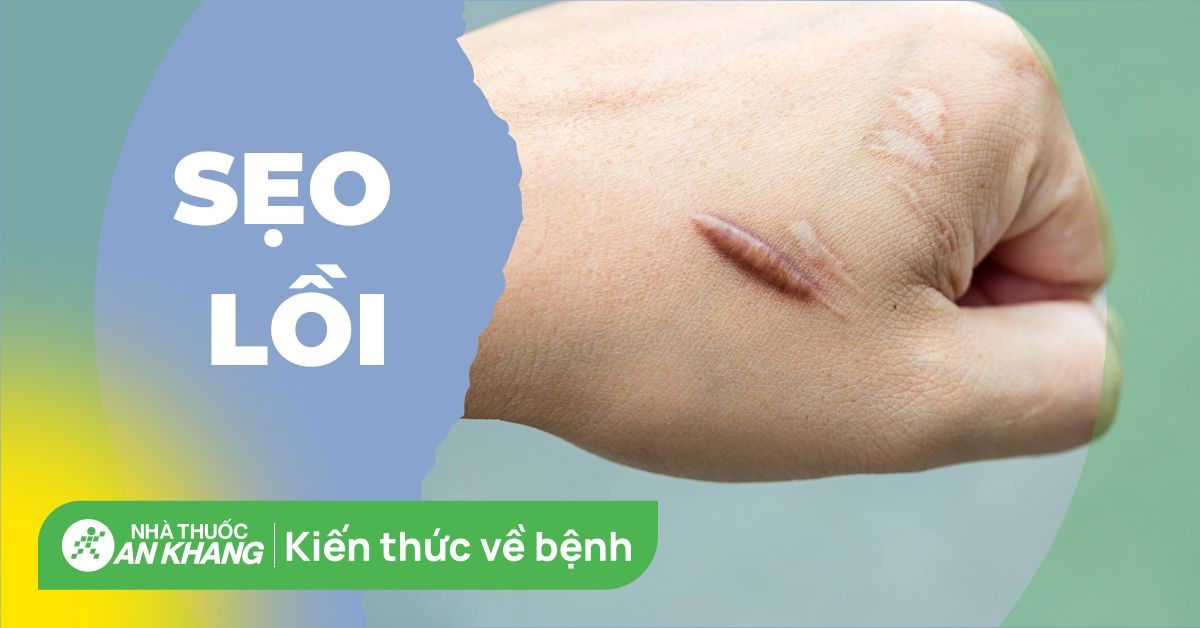 Sẹo lồi: Các nguyên nhân gây triệu chứng sẹo và cách điều trị hiệu quả