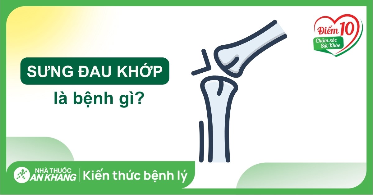 Tại sao khớp xương bị sưng đau? Khi nào cần điều trị