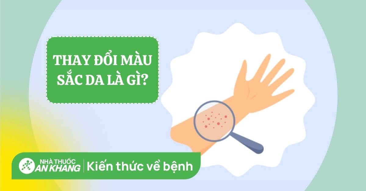Thay đổi màu sắc da là dấu hiệu của bệnh gì? Khi nào cần lo lắng