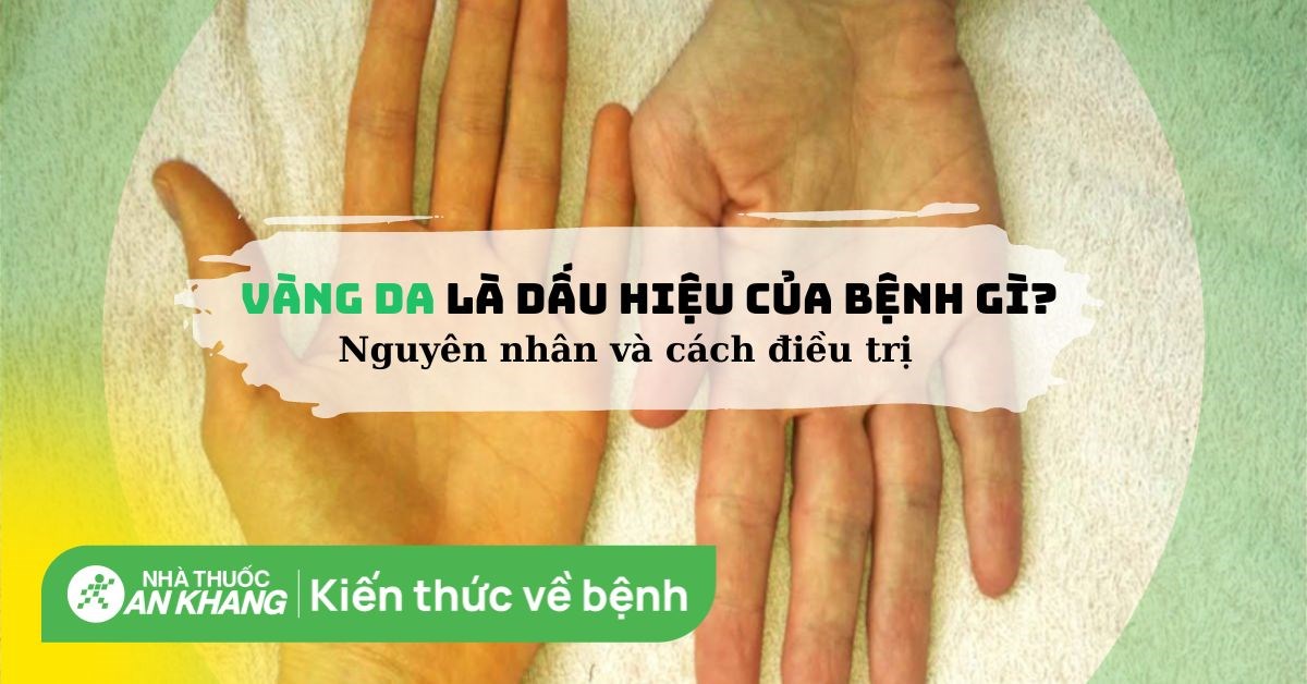 Vàng da là dấu hiệu của bệnh gì? Nguyên nhân và cách điều trị