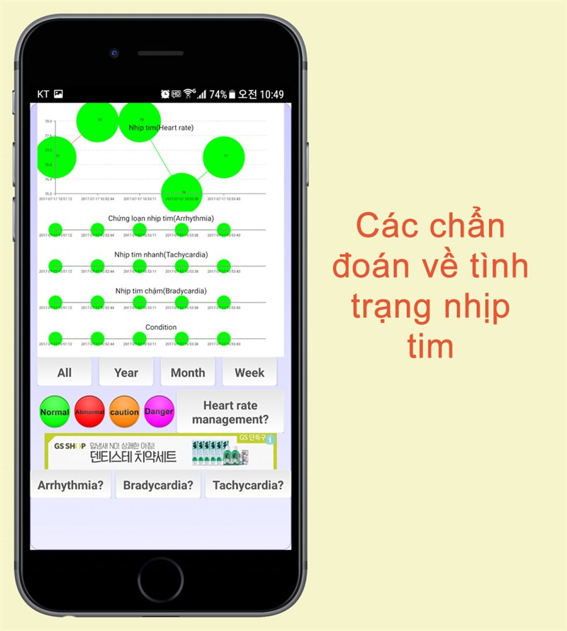 C&aacute;c chẩn đo&aacute;n về nhịp tim tr&ecirc;n ứng dụng Chẩn đo&aacute;n tim