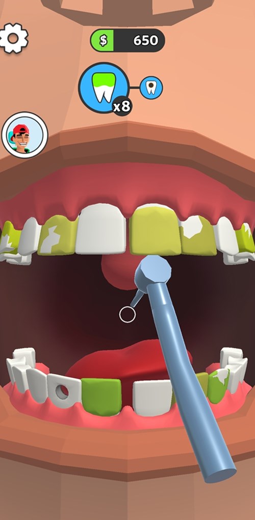 Loại bỏ các mảng bám sâu răng