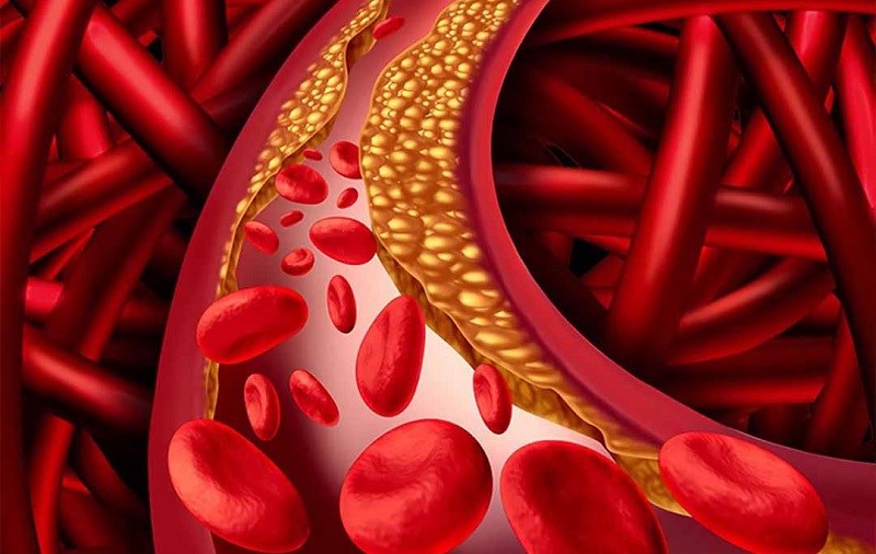 Tsoát hoa atiso đỏ giảm các chất mỡ bụng vào máu