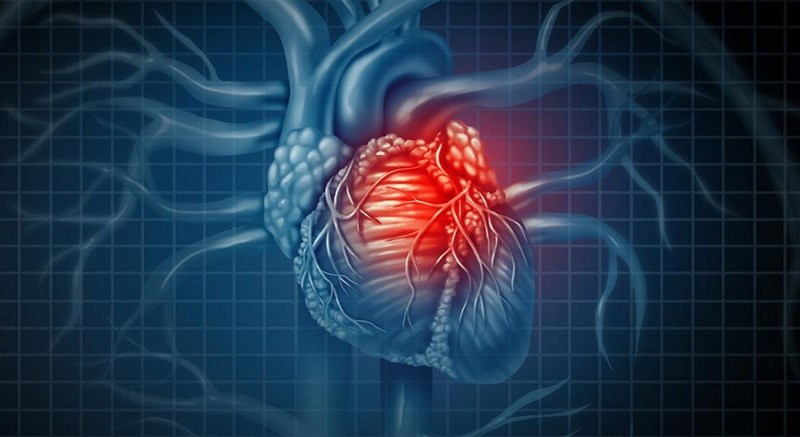 Nghệ giảm nguy cơ bệnh tim