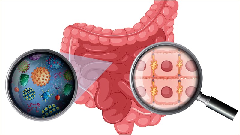 Lợi &iacute;ch của thực phẩm l&ecirc;n men