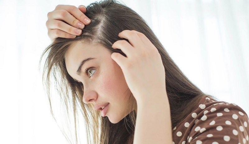Vitamin D giảm rụng tóc và kích thích mọc tóc