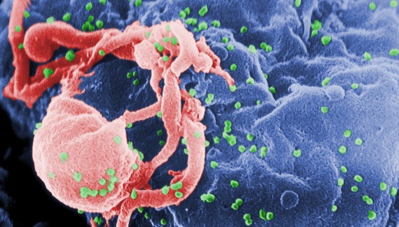 Bột quế chống virus HIV