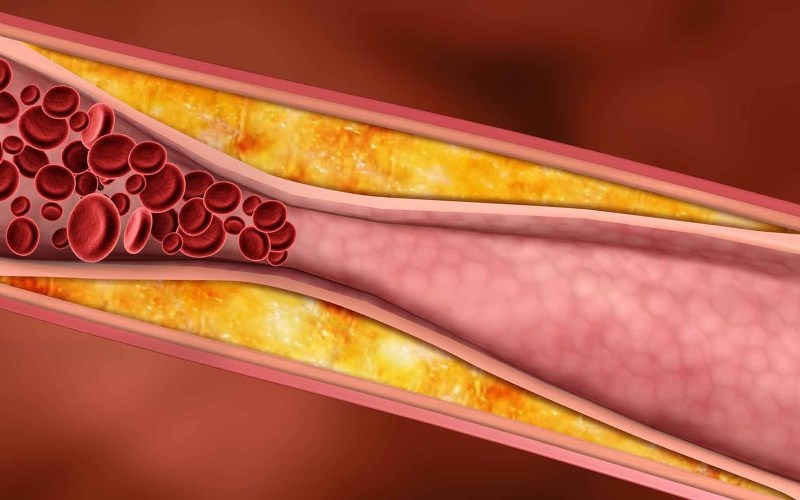 Cây xô thơm làm giảm lượng cholesterol