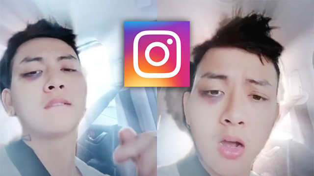 Loại hiệu ứng filter nào giúp giảm mắt thâm và có hình dạng gấu trúc trên ứng dụng Instagram?