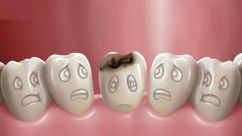 Ăn nhiều đồ ngọt g&acirc;y s&acirc;u răng