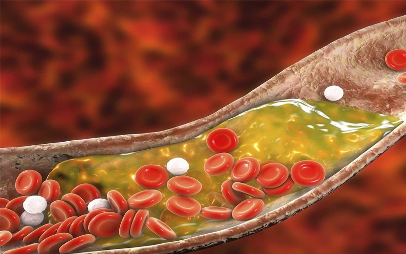 Tảo Spirulina hỗ trợ điều hòa lượng cholesterol