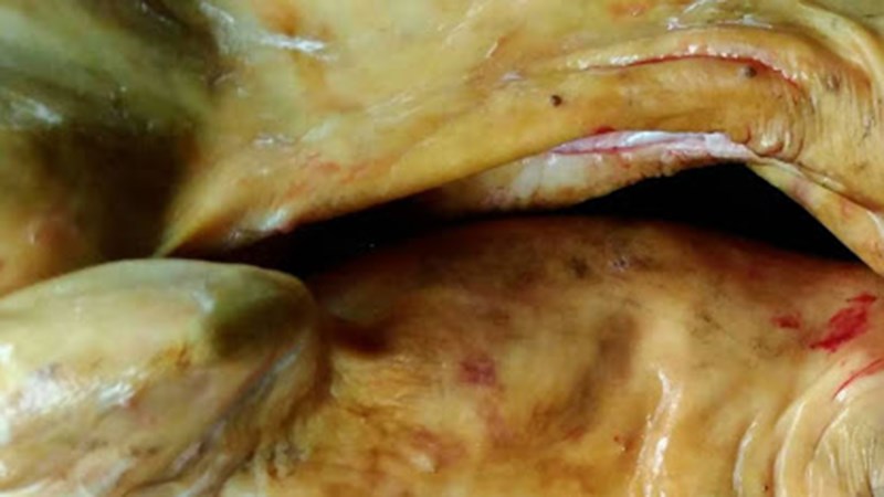 thui v&agrave;ng thịt thỏ