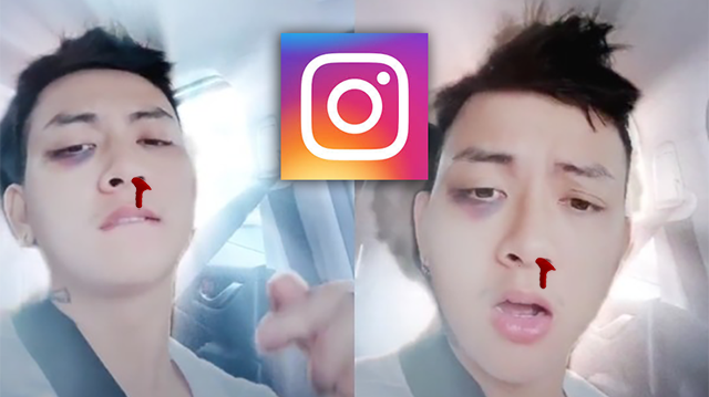 Làm sao để áp dụng filter chảy máu mũi cho ảnh trên Instagram?