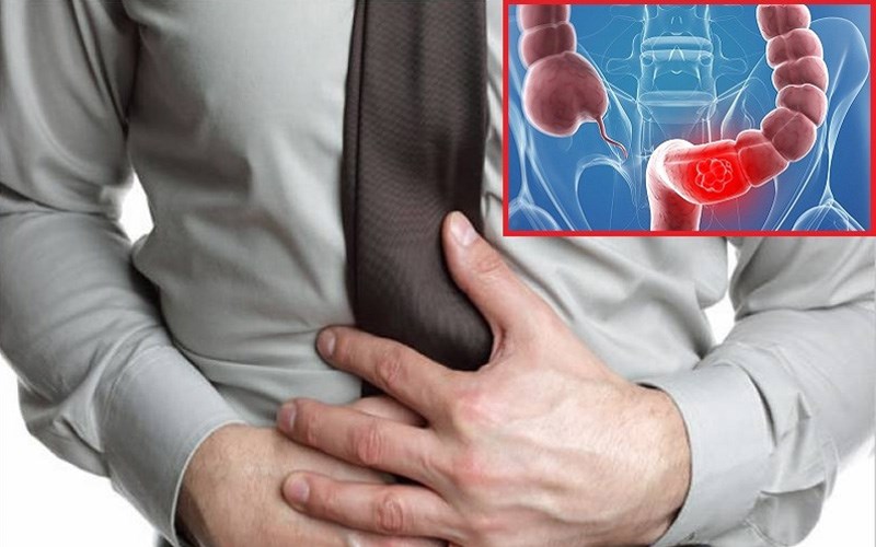 Nước vối góp sút triệu hội chứng viêm đại tràng
