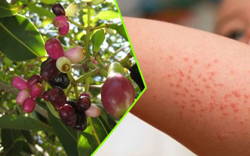 Nước lá vối trị bệnh dịch không tính da