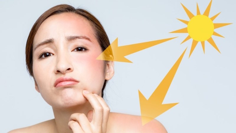 Hỗ trợ sức khỏe làn da