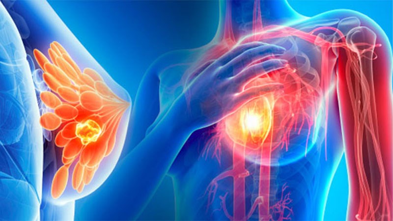 Sâm tố nữ có công dụng chống ung thư