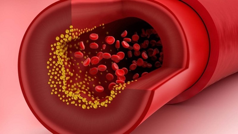 Giảm cholesterol xấu cho cơ thể