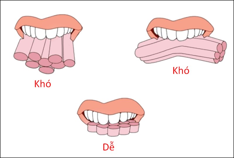 Cách xác định thớ thịt