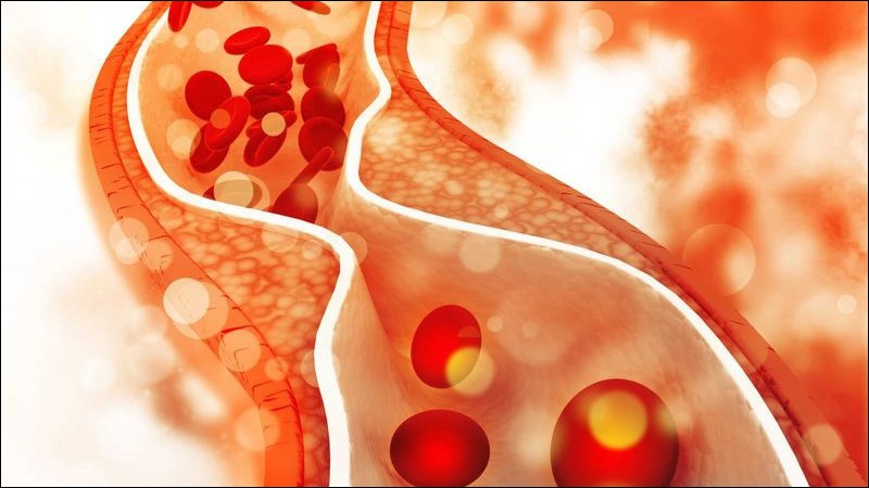 Ổn định cholesterol
