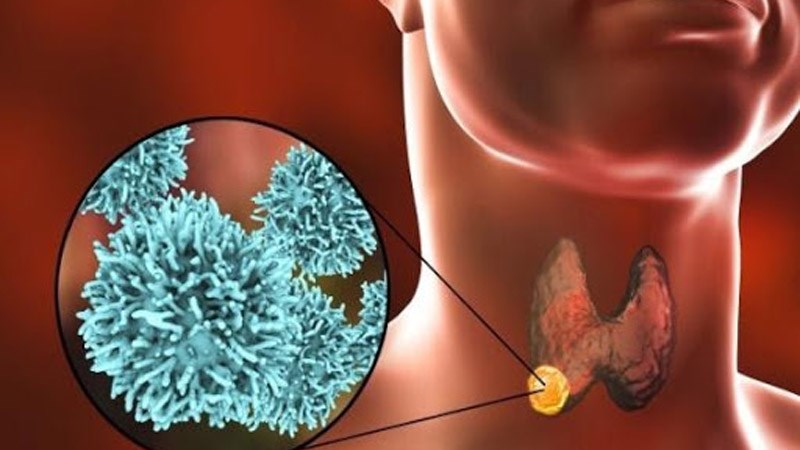 Ăn các ớt có nguy cơ tiềm ẩn mắc ung thư