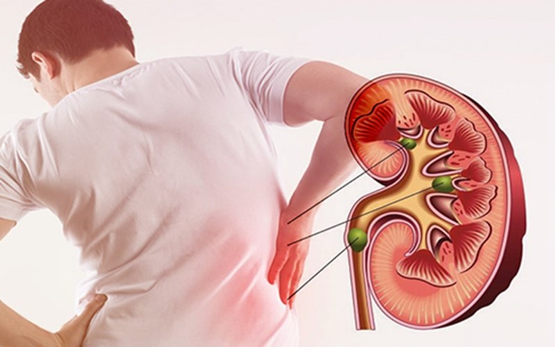 Người không nên ăn quả nam việt quất