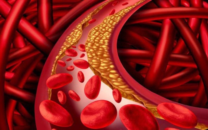 Ổn định lượng cholesterol 