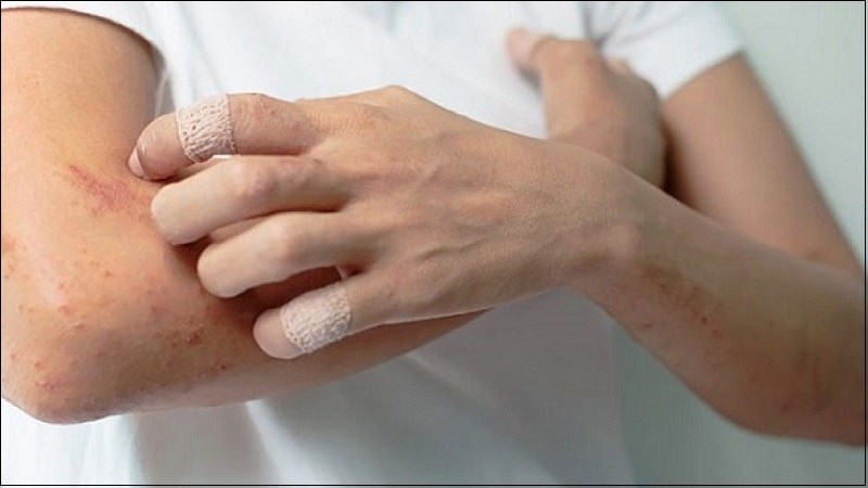 Có thể giúp làm giảm các viêm mãn tính