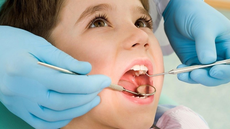 Lưu ý để răng miệng khỏe mạnh