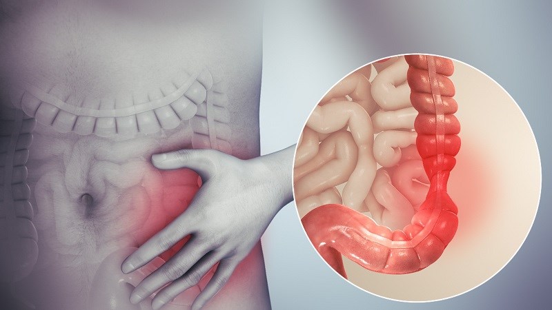 Tốt cho bệnh nhân viêm ruột