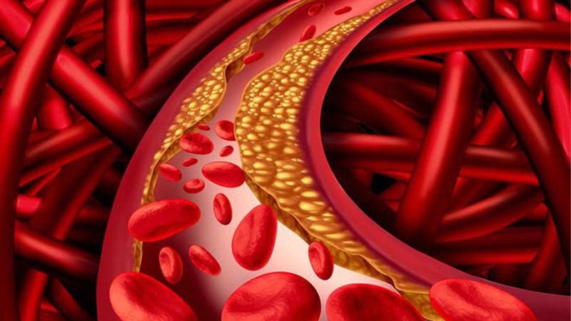 Dầu hạt cải làm giảm lượng cholesterol