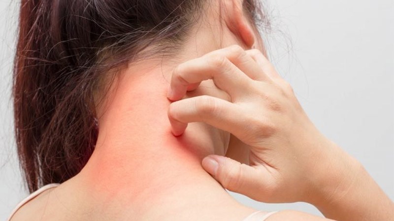 Ăn cà rốt có thể bị dị ứng