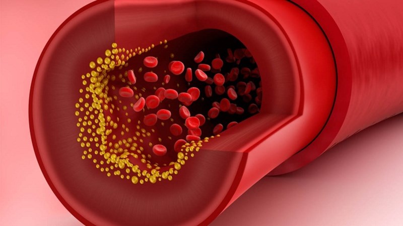 Giảm nấc cholesterol